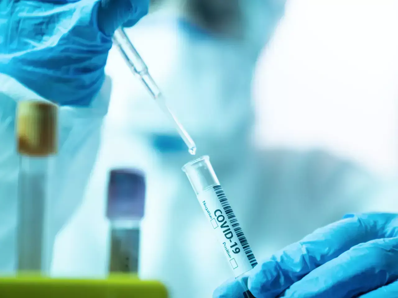 കോവിഡ്-19: ഉത്ഭവം ചൈനീസ് ലാബില്‍നിന്നല്ലെന്ന് യുഎസ് ഇന്റലിജന്‍സ്