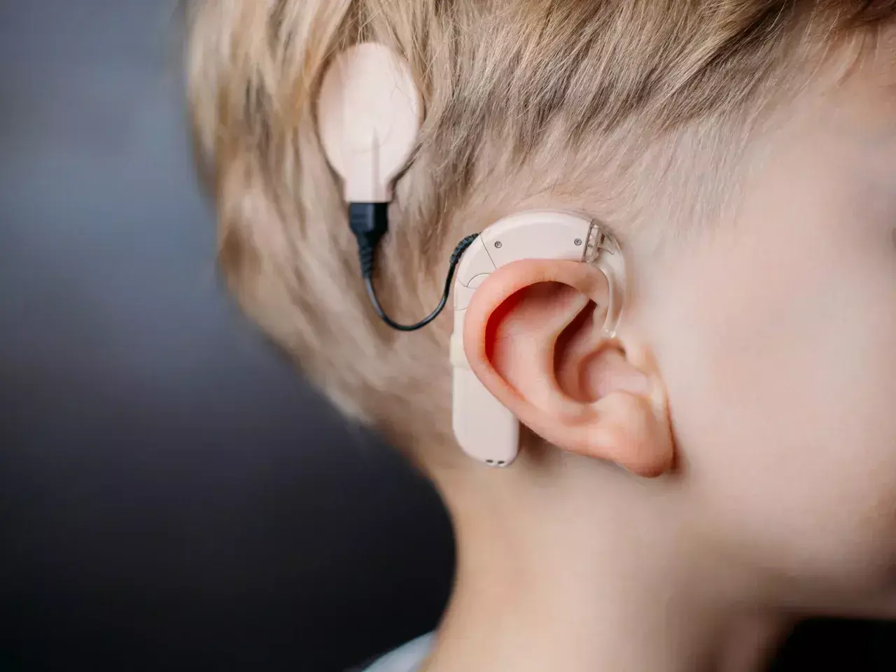 cochlear implantation 59 lakhs allocated by the finance department