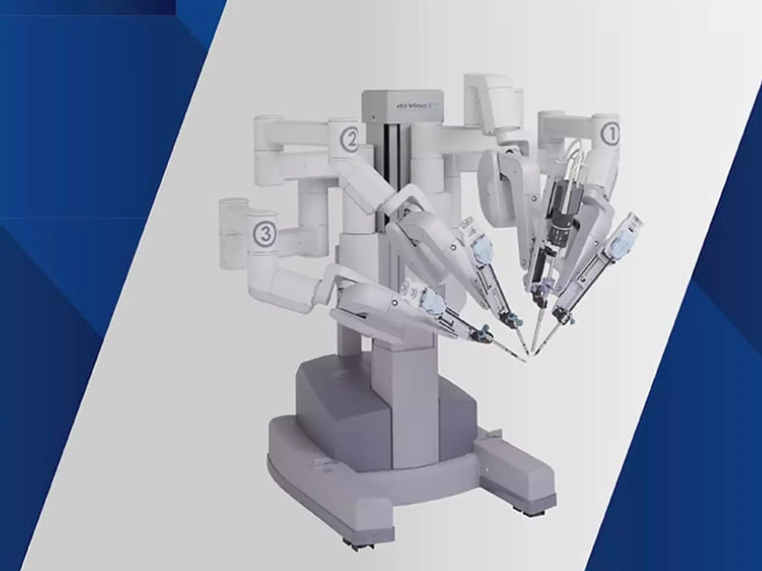 Robotic oncology program with 4th gen Da Vinci Surgical System Xi