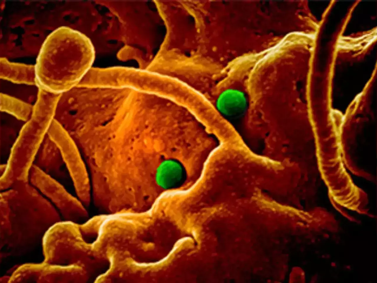 virus again in china, spreading rapidly, report